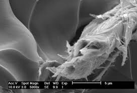 Wood Dust Particle Micrograph